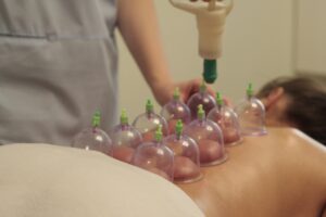 Close-up of a relaxing cupping therapy session in a soothing spa environment.